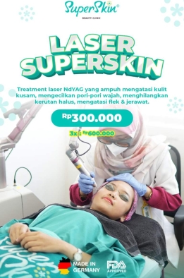 Keunggulan Threatment Kecantikan Menggunakan Laser di Superskin