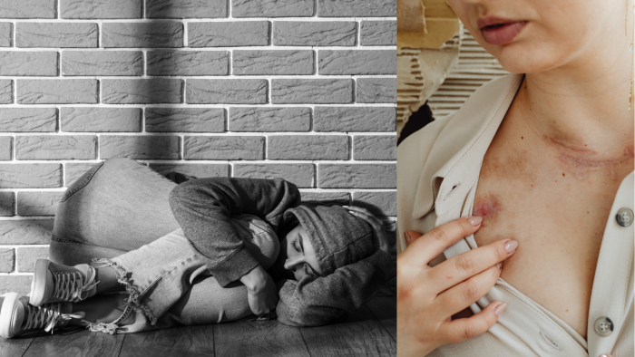 Unit PPA Satreskrim Polres Lamongan Tangani Dugaan Pemerkosaan terhadap Perempuan Disabilitas di Pucuk